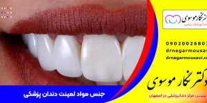 21021-material-dental-laminate- جنس بهترین مواد لمینت دندان پزشکی اصفهان از چیست-دندانپزشکان زیبایی اصفهان